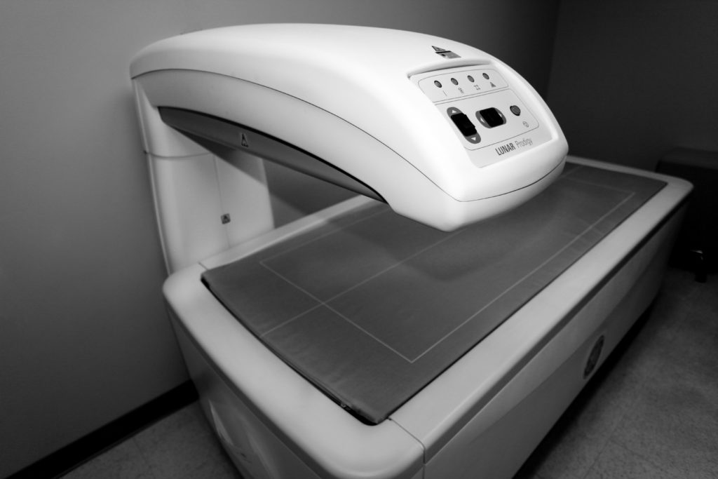 bone-density-fairfield-memorial-hospital